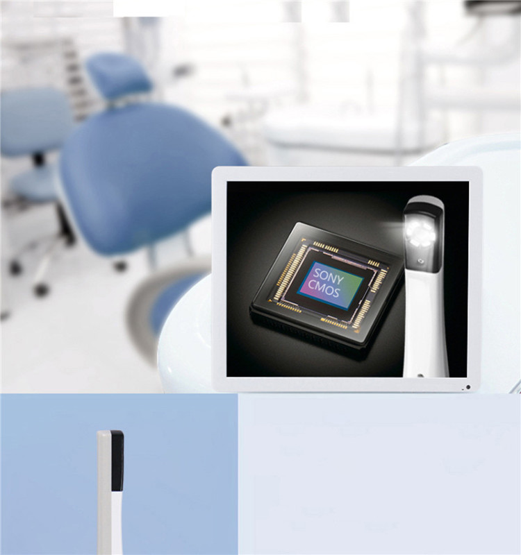 DX-01U Dental Intraoral Camera USB Digital  2.0 Mega Pixels 1/4" Sony  CCD