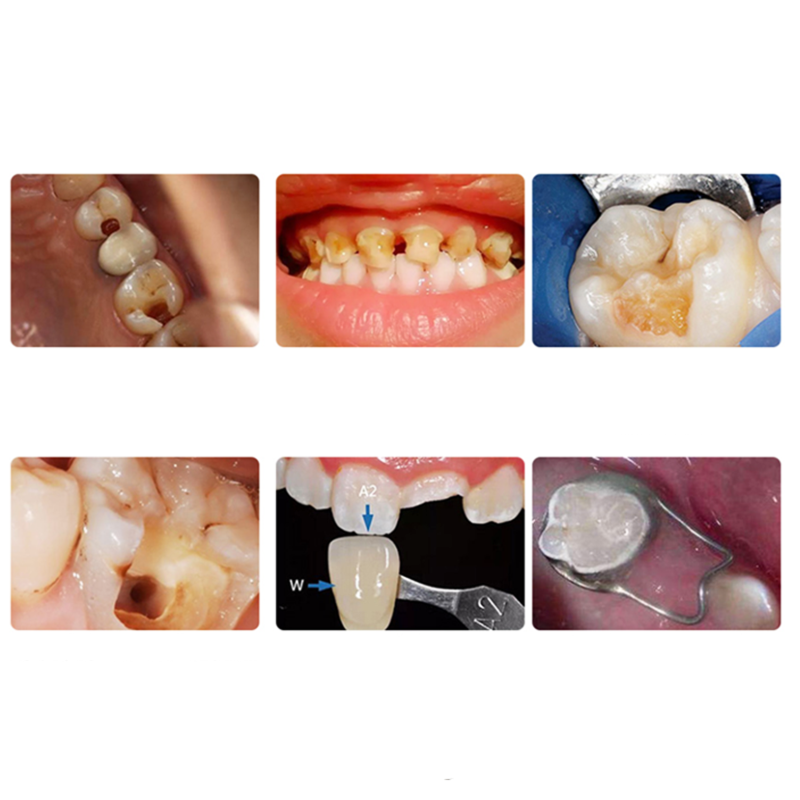 48pcs Dental Kids Primary Molar Crown Stainless Steel Pediatric Preformed Crowns