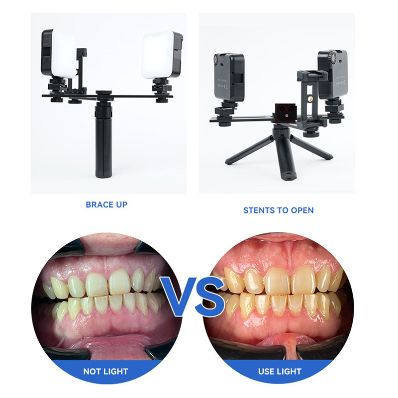 Dental Oral Filling Light Flash Photography Equipment Flash Photography Mobile
