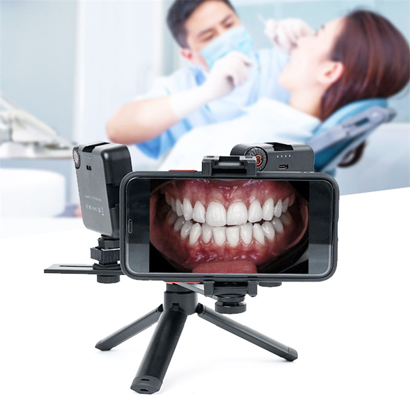 Dental Oral Filling Light Flash Photography Equipment Flash Photography Mobile