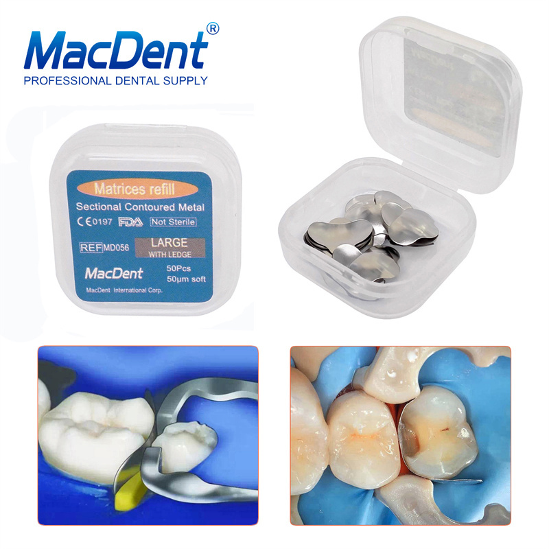 MacDent Dental Refill Sectional Contoured Metal Matrices With Ledge / Without Ledge 50Pcs/Pack