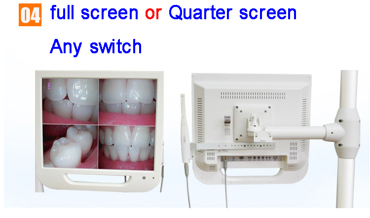 DMXDENT Dental Endoscopic Digital Imaging Intraoral Camera System DX-MC01/DX-300