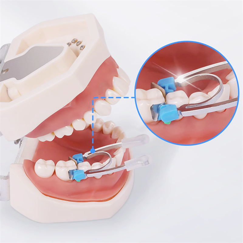 Dental Sectional Matrix System Matrices Metal Bands 30 Pcs Kit + Clip Ring Clamp