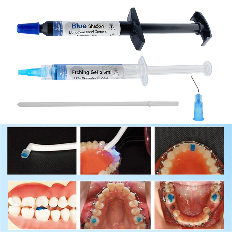 Fresh Dental Orthodontic Adhesive Light Cure Band Cement Blue Glue Intro Kit