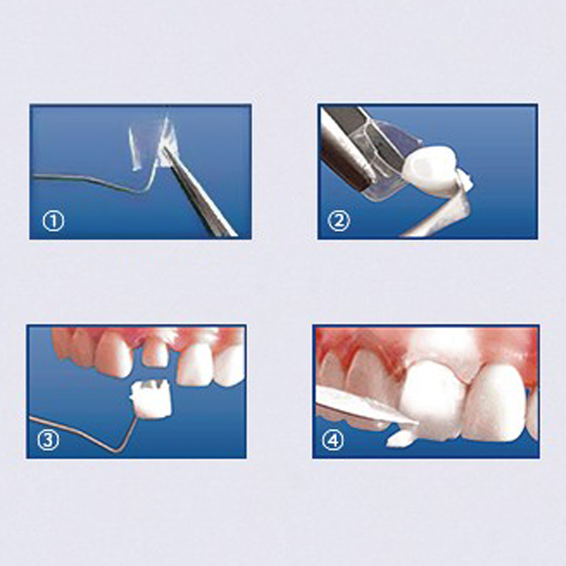 TOP BM 1.910 / 1.911 / 1.912 Dental Transparent Crown Posterior Matrices Matrix for Adult / Child Features 64pcs