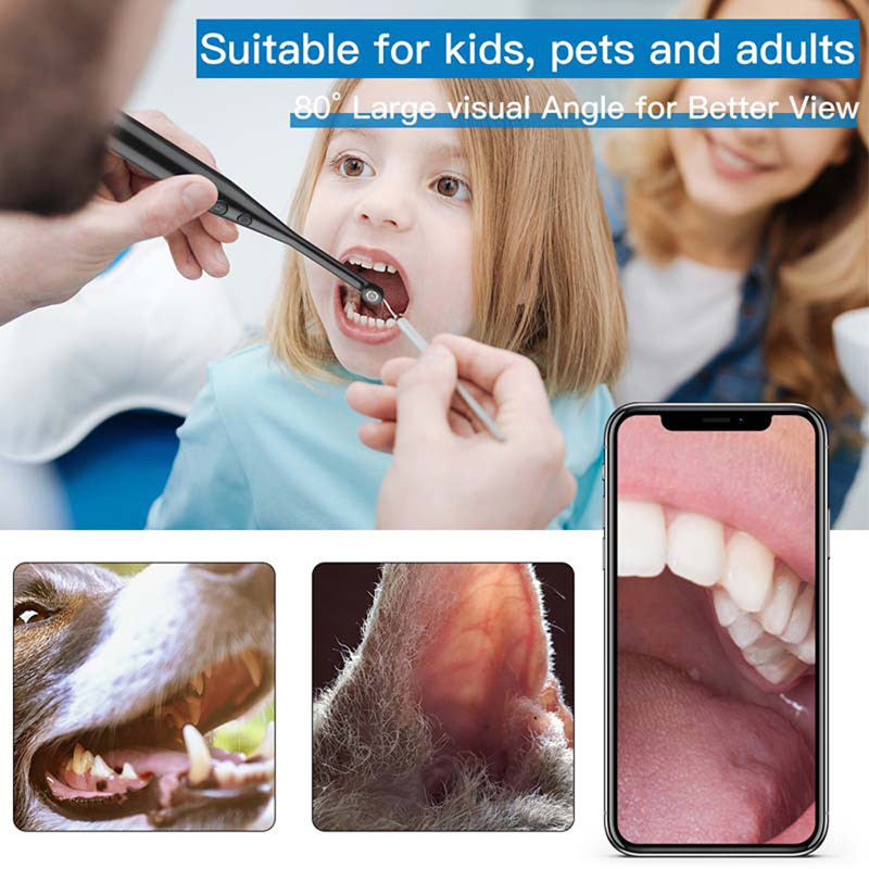 Dental Intraoral Camera Stomatoscope HD 720P 6 LED Adjustment Lights Household