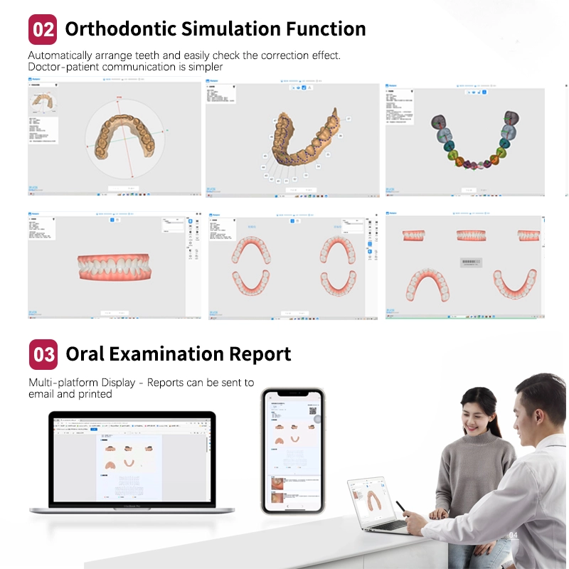 Runyes 3DS V5 Dental Intra-oral Scanner 3D Real-time Display Software ...