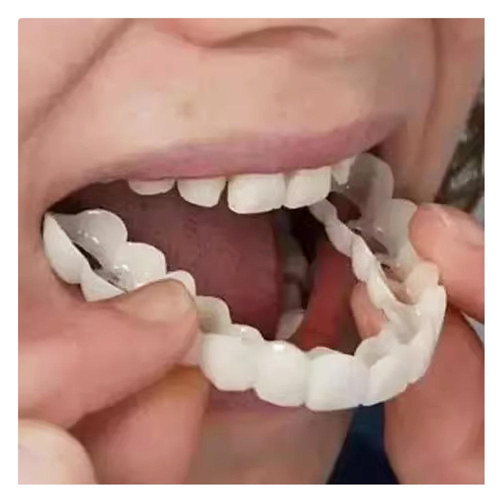 Tooth False Teeth Denture Veneers Dental Tooth False Teeth Set