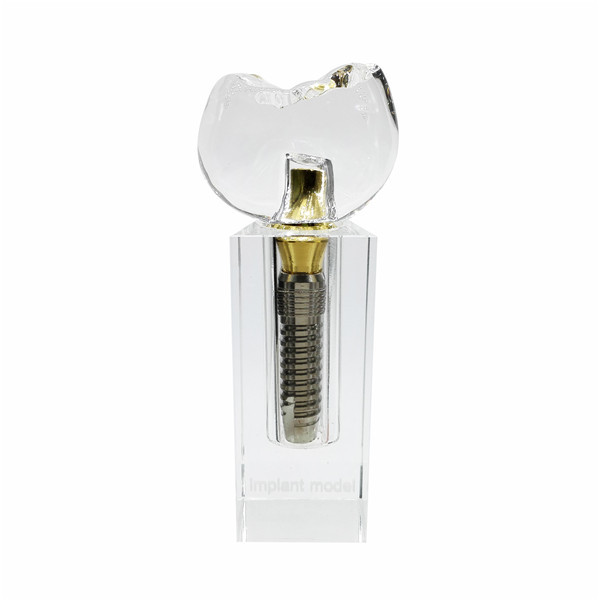 Dental Implant Demonstration Tooth Model Teeth Study Model