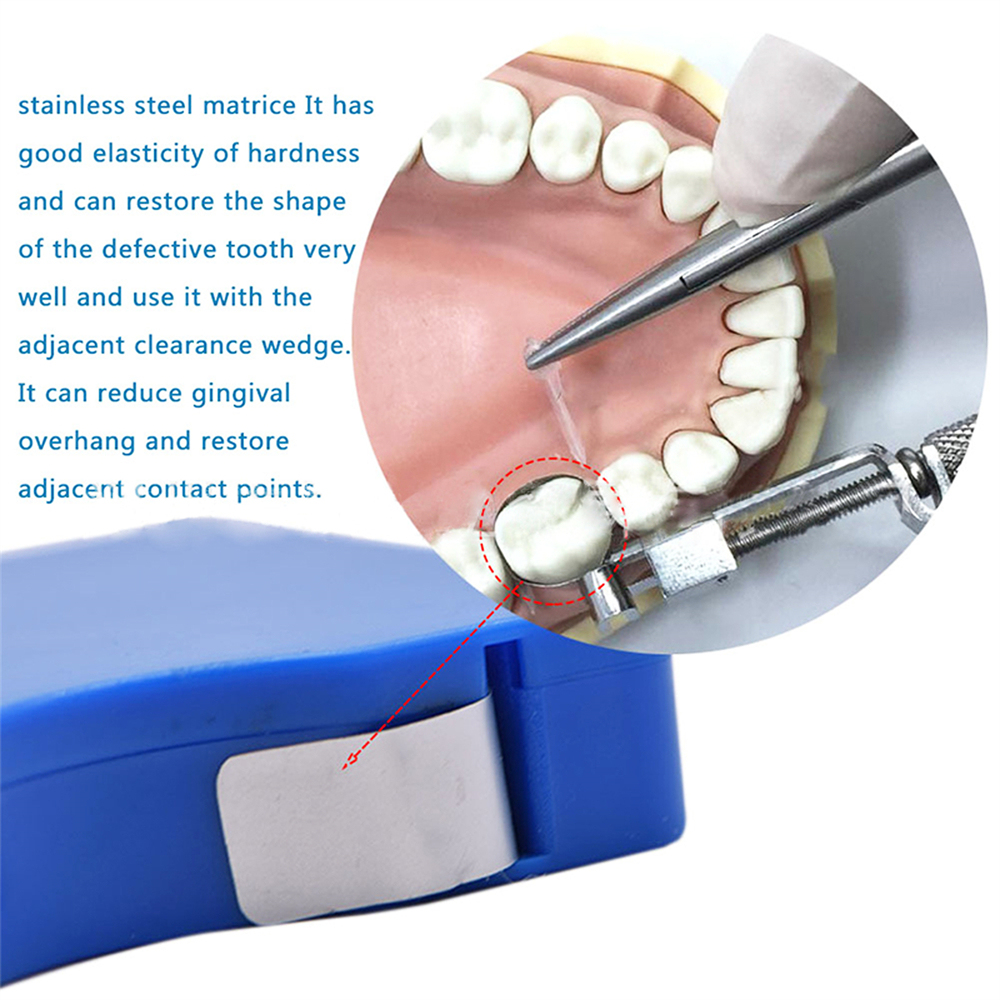 Dental Strip Roll SST Teeth Restoration Matrix Matrice Bands / Retainer