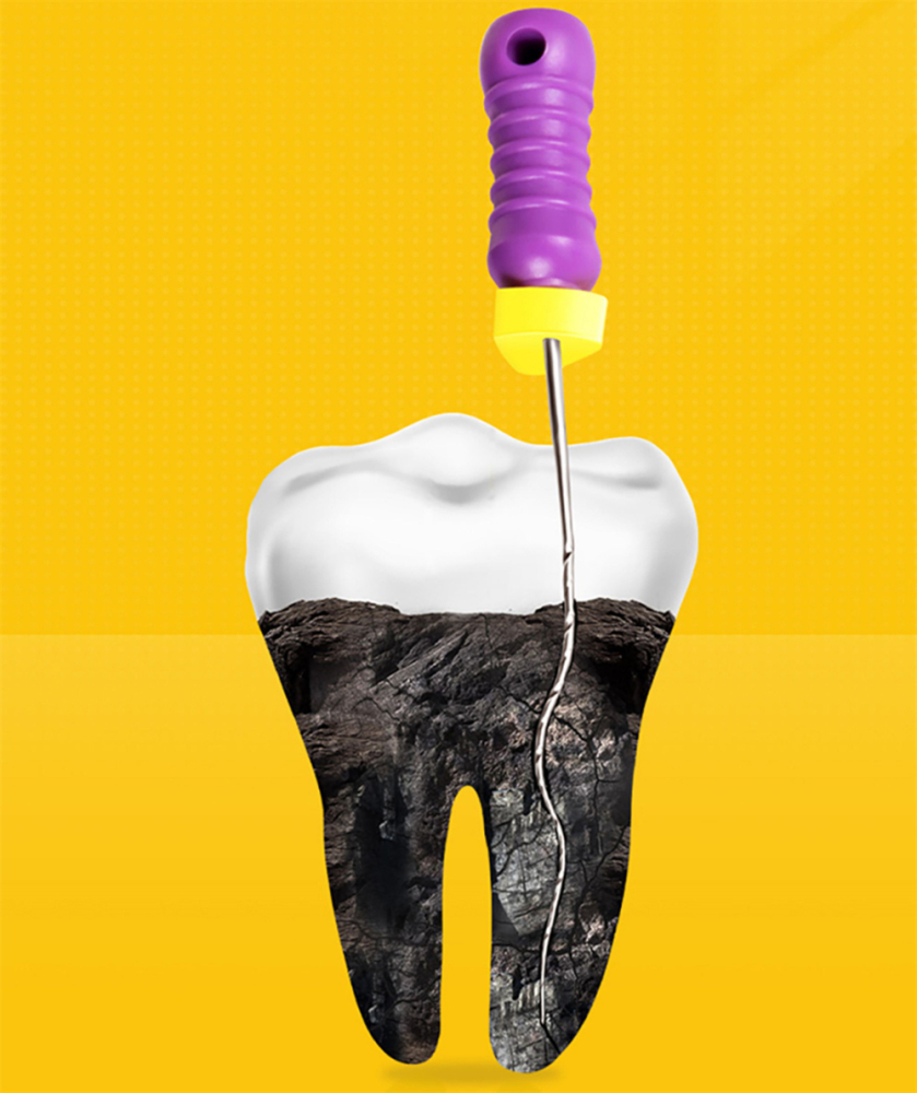 Mani D FINDERS Dental Endodontic files For Calcified Canals 21/25mm