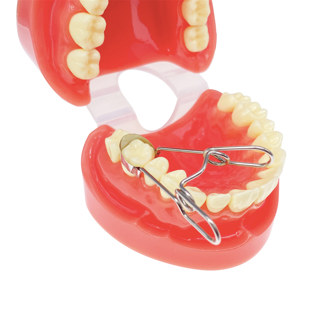 Dental Saddle Contoured Metal Matrices Matrix Band 6 Sizes