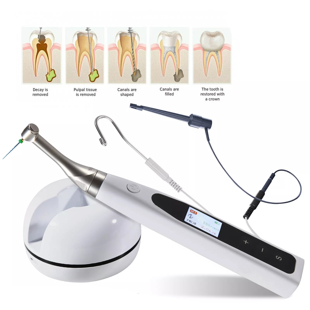 Woodpecker Style 2 in 1 Wireless Dental Endo Motor Reciprocating & Apex Locator / PT-Blue Files
