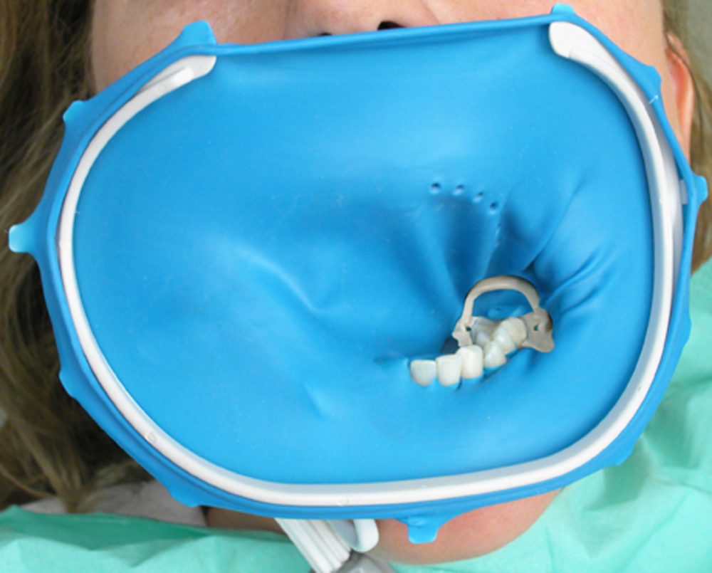 Dental Endo 3D Frame X-Ray Film Plastic Rubber Dam Sheets Holder