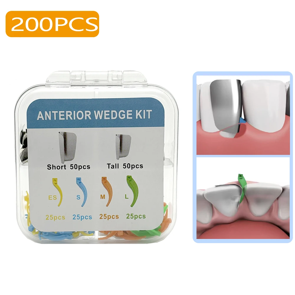 200Pcs Dental Supplies Anterior Matrix System Wedge Matrix Bands Interdental