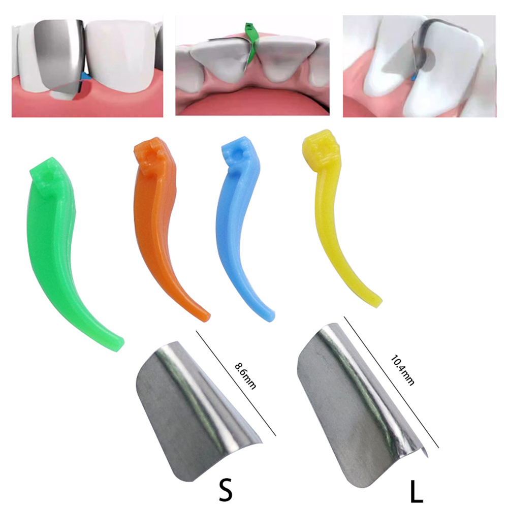 200Pcs Dental Supplies Anterior Matrix System Wedge Matrix Bands Interdental