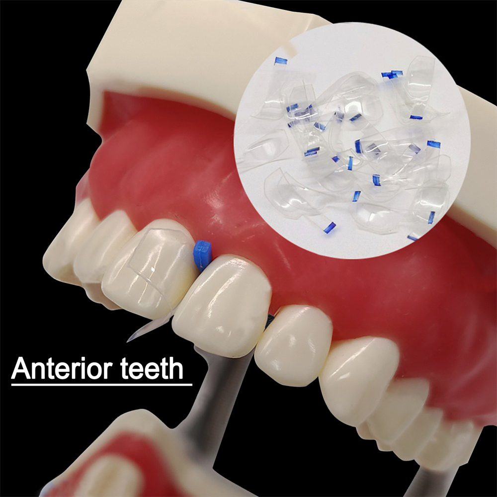 30Pcs Dental Clear Sectional Contoured Matrices Matrix for Anterior/Posterior