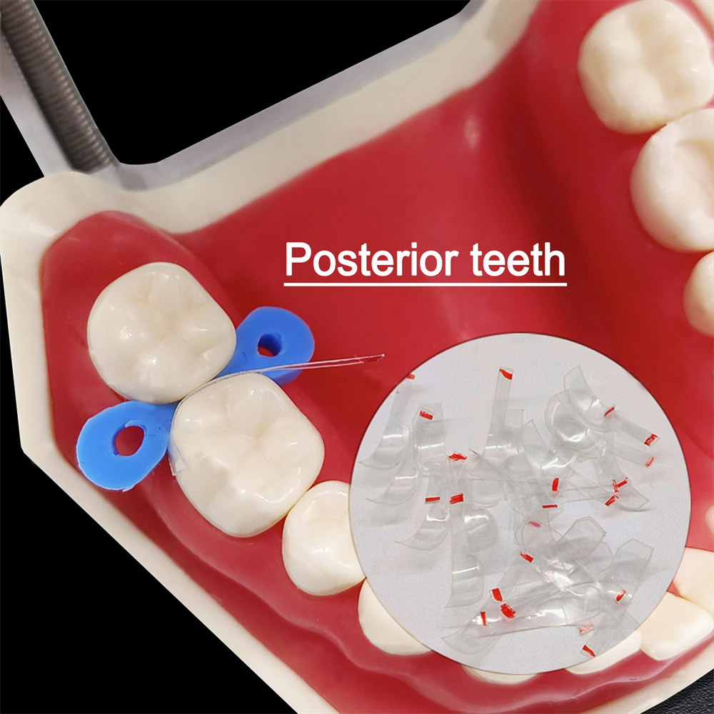 30Pcs Dental Clear Sectional Contoured Matrices Matrix for Anterior/Posterior