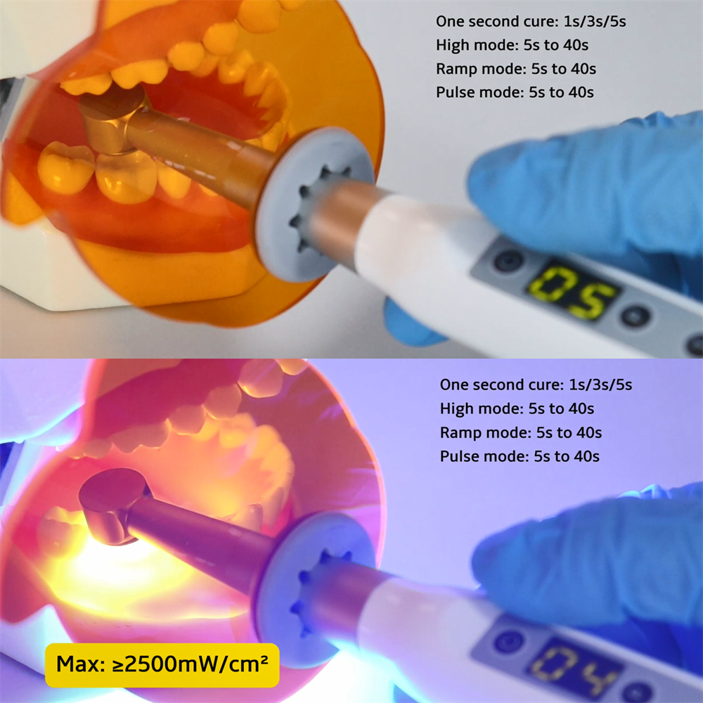 Dental 1 Second Curing Wireless LED Curing Light Lamp 2500mw/c㎡