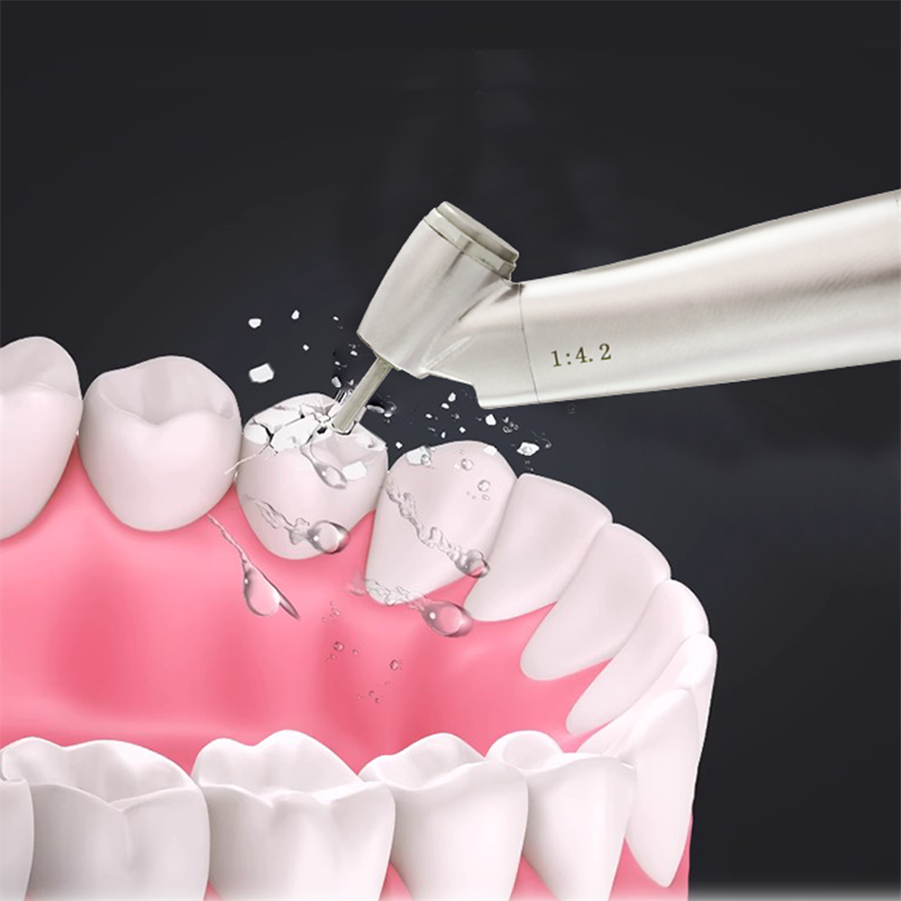 POPDENT Dental 45 Degree 1:4.2 Increasing Fiber Optic Electric Contra Angle Handpiece