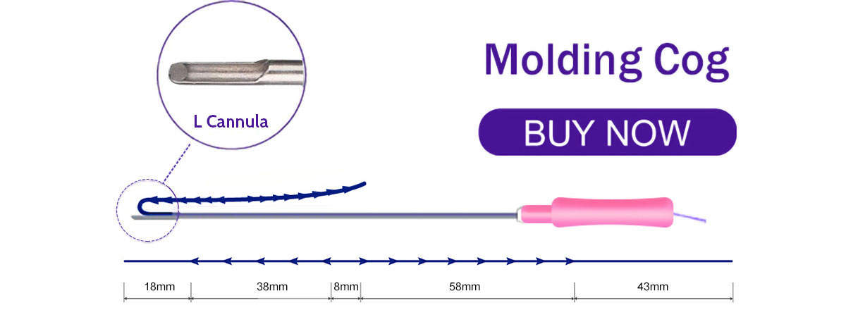 Molding Thread Picture