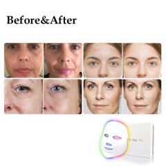 D.seahorse beauty 7 color face mask led light photon therapy