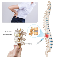 D.Seahorse 1ml hyaluronic acid injection price knee