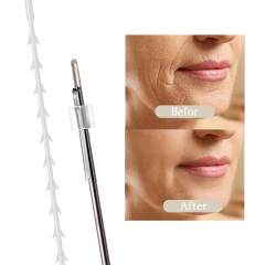 D.Seahorse Pcl thread Cones thread 18G 19G 100mm face lifting