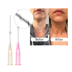 High quality mono scrow face lift needle pcl thread