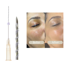 D.Seahorse tornado/tornado Screw pcl thread face Remove wrinkles