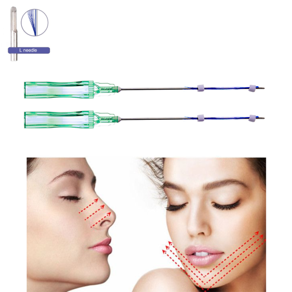 Factory Wholesale Multi Thread 8/12 Lines 21/23G Multi PDO PCL PLLA Thread For Neck Wrinkles