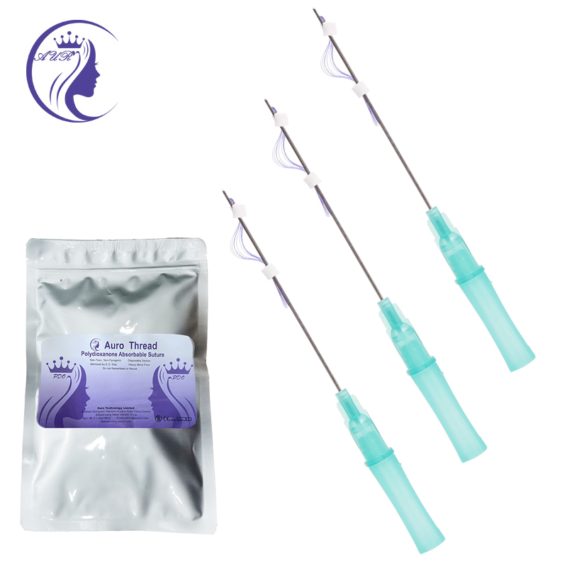 Cost comparison chart for PDO thread treatments