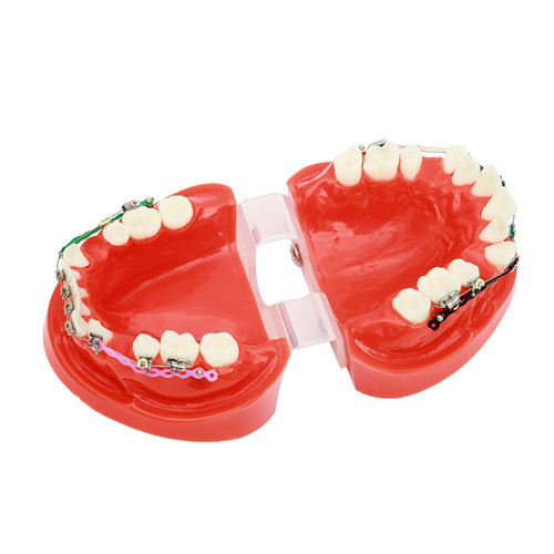 ****Dental Ortho Teeth Study Model With Bracket Elastolink Chain Teeth Model