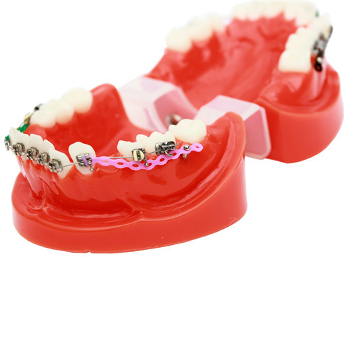 ****Dental Ortho Teeth Study Model With Bracket Elastolink Chain Teeth Model