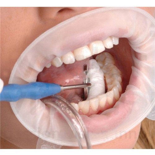 ****1 pc Soft Lip Dental Sterile Rubber Dam Cheek Retractor Mouth Opener