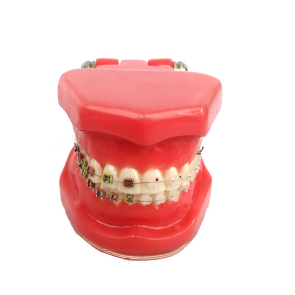 ****Dental Orthodontic Study Teeth Model With Ceramic & Metal Brackets