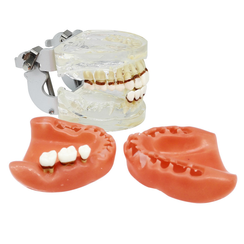 ****Dental Teeth Model Study Teach Standard Typodont Model with Removable Teeth