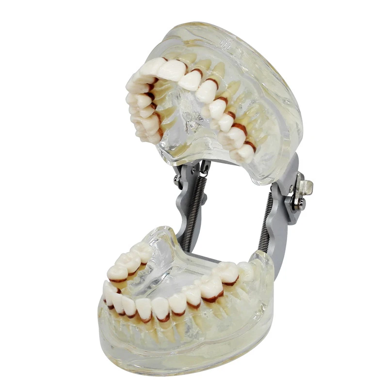 ****Dental Teeth Model Study Teach Standard Typodont Model with Removable Teeth