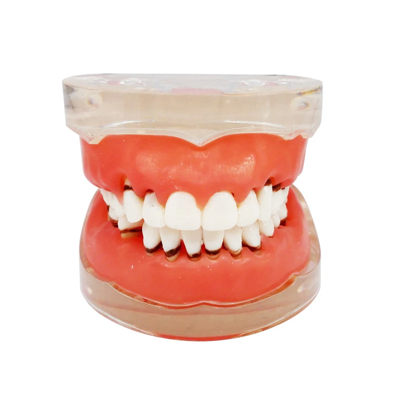 ****Dental Teeth Model Study Teach Standard Typodont Model with Removable Teeth