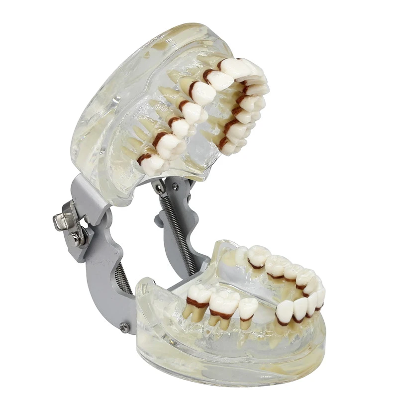 ****Dental Teeth Model Study Teach Standard Typodont Model with Removable Teeth