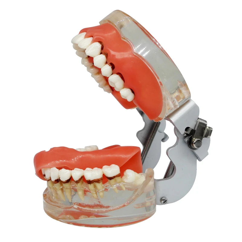 ****Dental Teeth Model Study Teach Standard Typodont Model with Removable Teeth