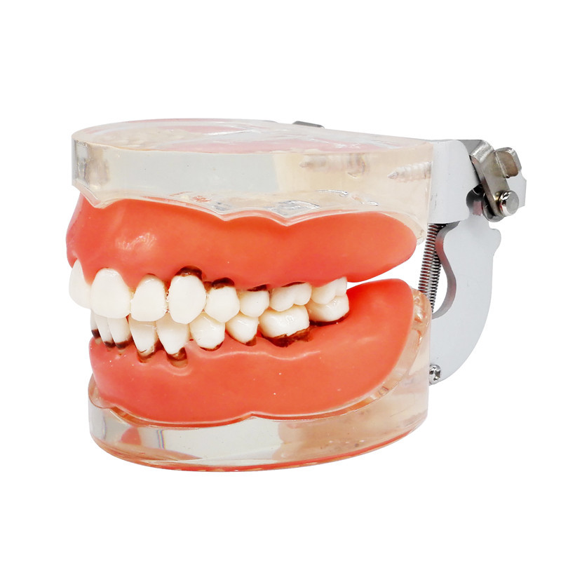 ****Dental Teeth Model Study Teach Standard Typodont Model with Removable Teeth