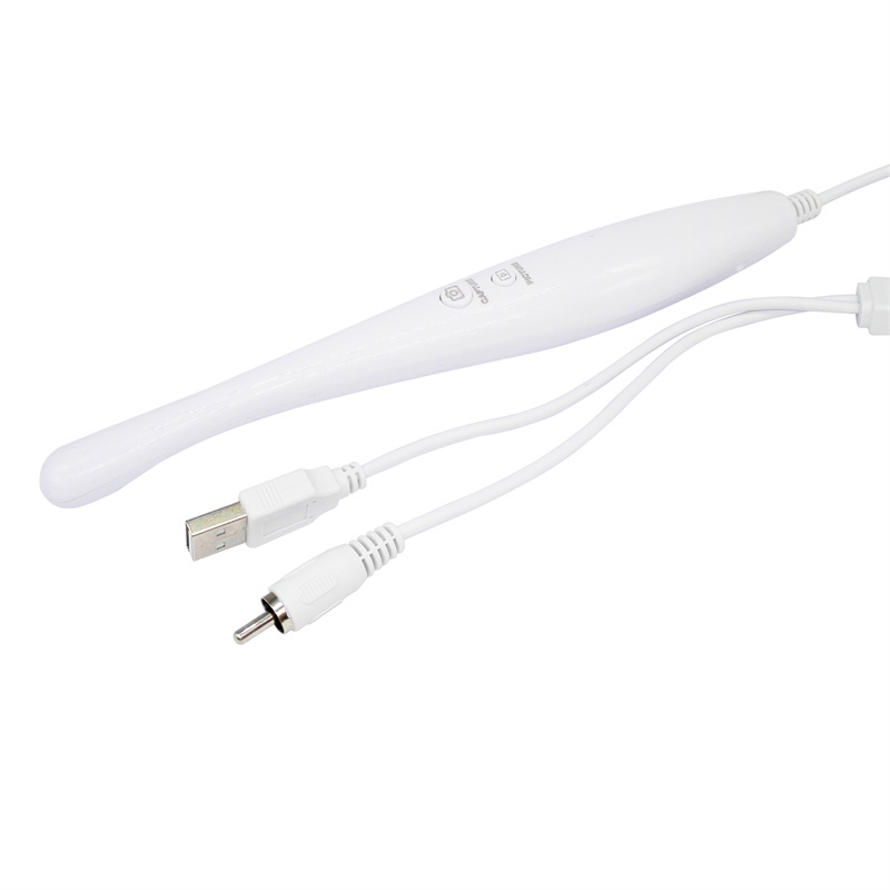 Dental DX-03AV Intraoral Camera System CMOS1/4 Embedded Operating System