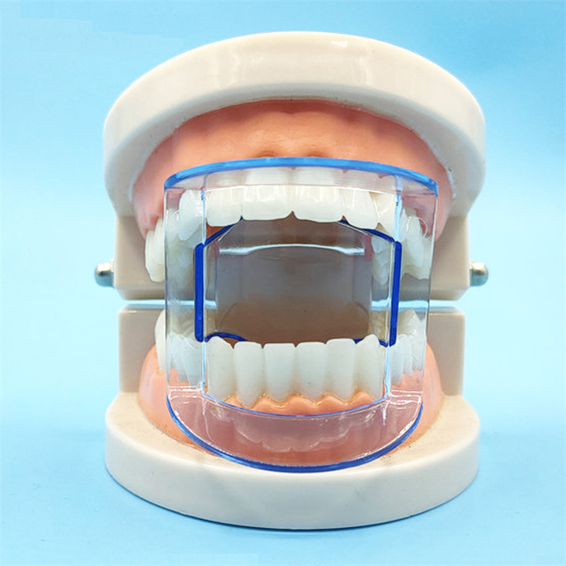 Dental Anterior/Posterior Mouth Opener Bite Prop Lip Retractor Cheek Expande