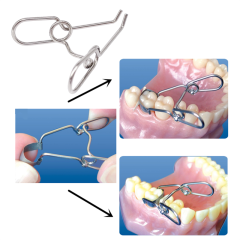Dental Matrix Saddle Contoured Matrices Spring Clips Orthodontics Oral Tool Installation A Shape
