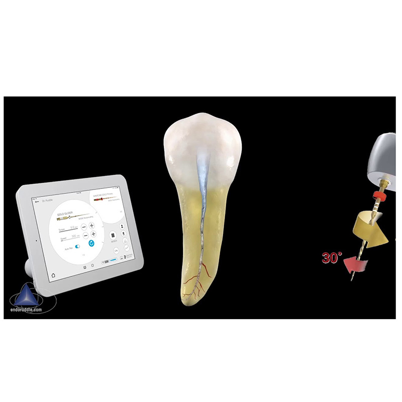 Waveone Gold Glider 21mm 25mm 31mm ENDODONTIC RECIPROCATING Glide Path Dentsply 3 files