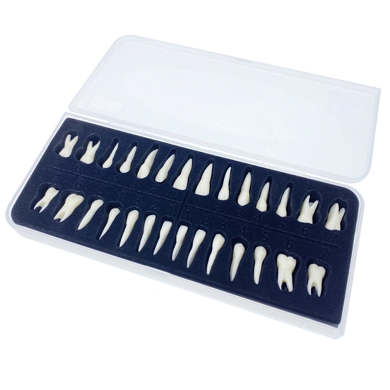 ALANDENTAL Dental Typodont Lower Teeth Model With Overdenture And 4 Implants, Study Demo Model 6002 02
