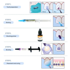 `Dental Orthodontic Light Cure Bonding Adhesive Kit For Brackets Braces