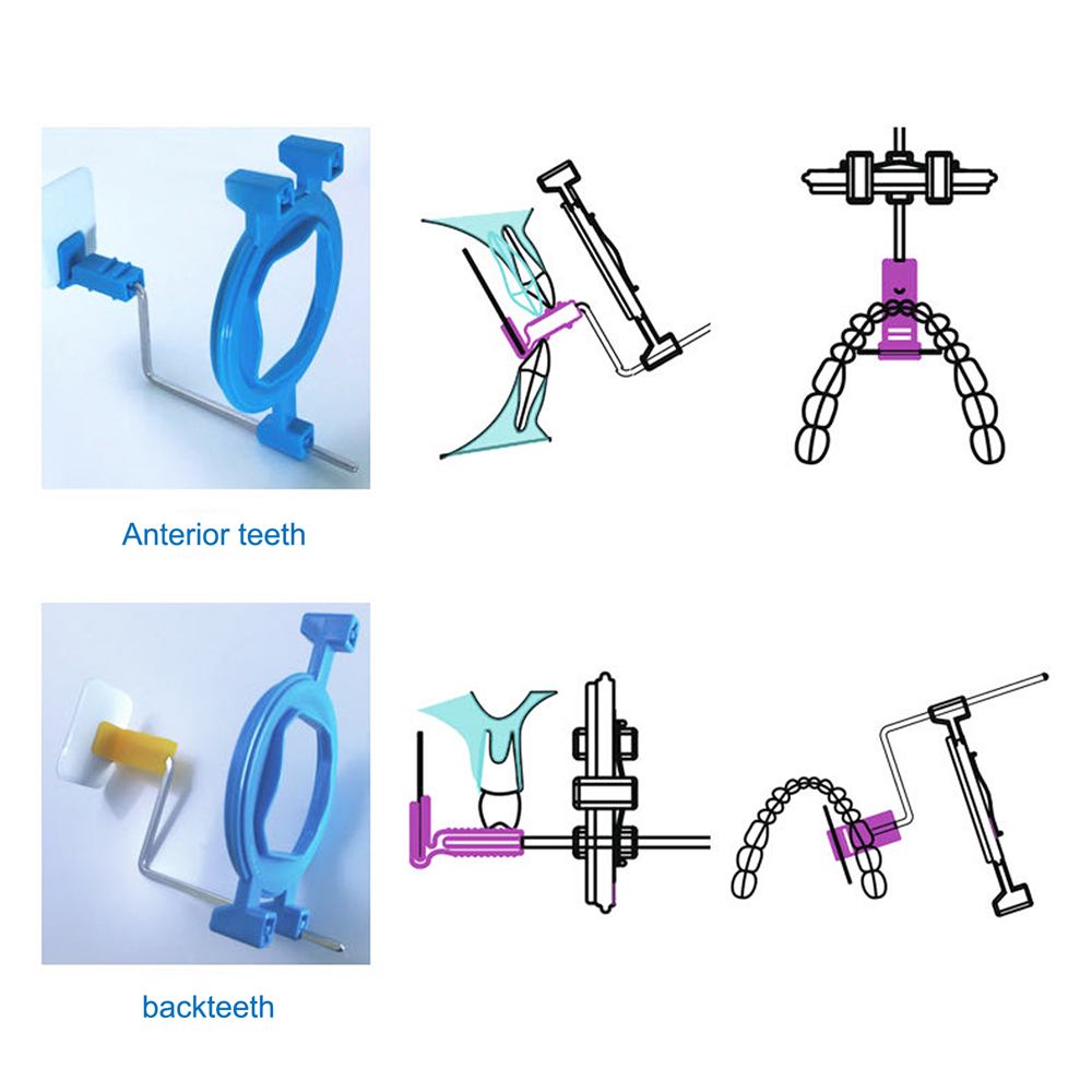 12 Pcs Dental Film Positioning & Digital Phosphor Plate Positioner System Holder