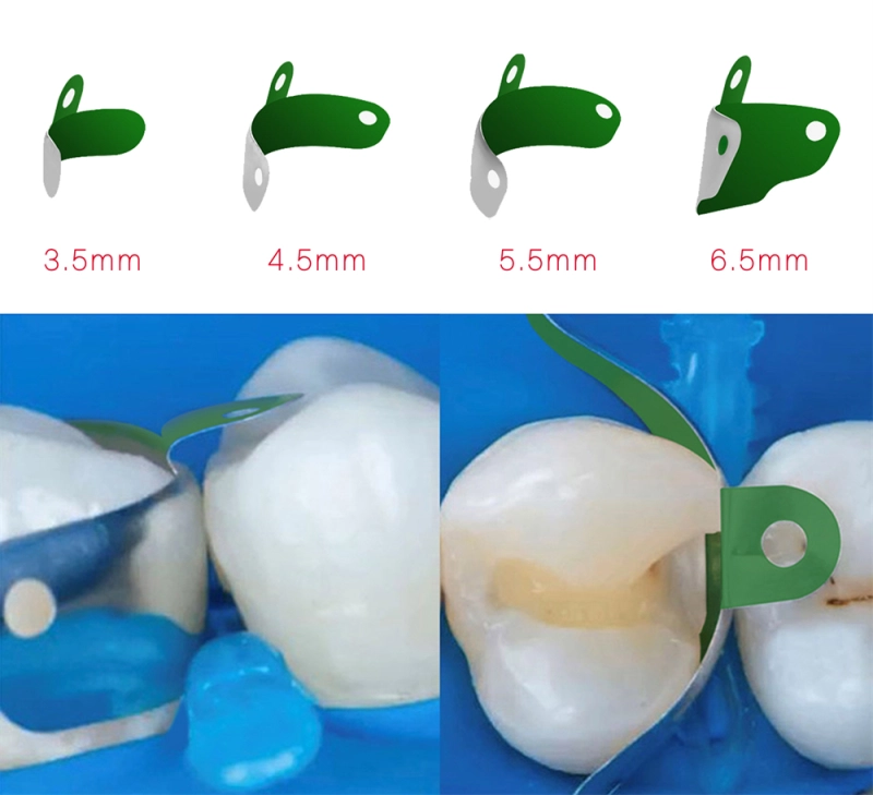 50 Pcs Dental Teflon Composite Coating Non-Stick Matrix Bands Sectional ...